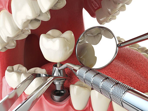 Best Pediatric Emergency Dentist in Brewster, OH